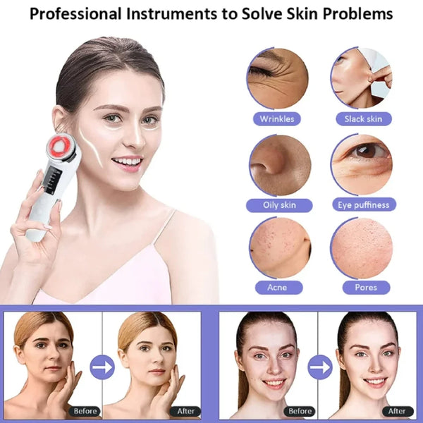 7 in 1 Face Lift Devices EMS RF Facial Massager